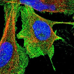 Aquaporin 1/AQP1 Antibody, Novus Biologicals 25 &mu;L; Unlabeled:Antibodies,